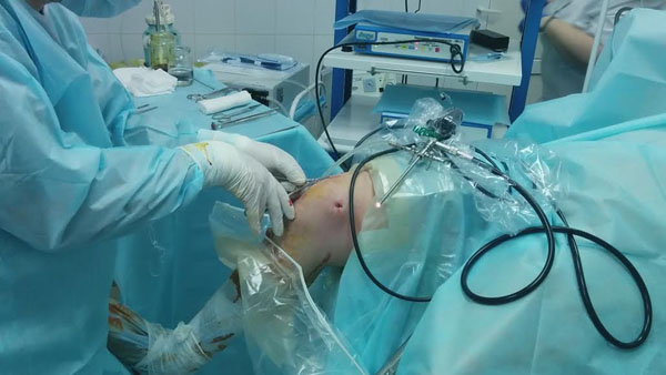 Успешно проведена операция «Гнойный артрит коленного сустава справа, синдром системного воспалительного ответа»