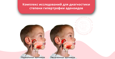 Комплекс исследований для диагностики степени гипертрофии аденоидов Комплекс исследований для диагностики степени гипертрофии аденоидов