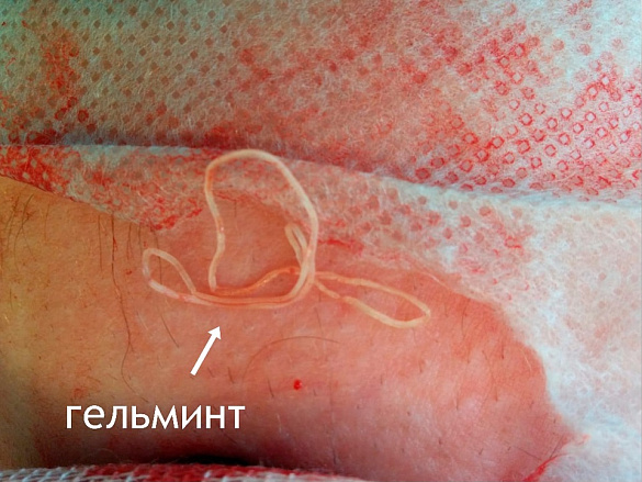 Клинический случай дирофиляриоз Клинический случай дирофиляриоз